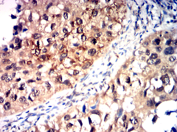 CYP1B1 Antibody