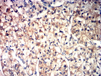 CYP1B1 Antibody