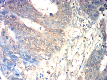 EIF5A Antibody