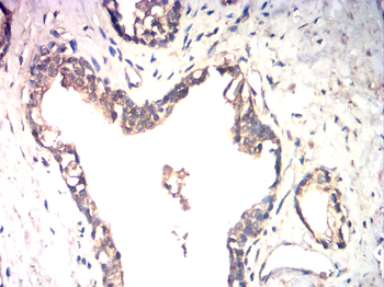 CTNNB1 Antibody