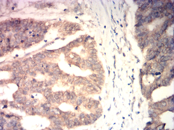 CTNNB1 Antibody