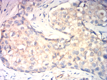 CTNNB1 Antibody