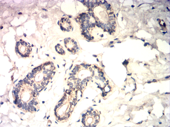 CTNNB1 Antibody