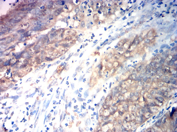 CTNNB1 Antibody