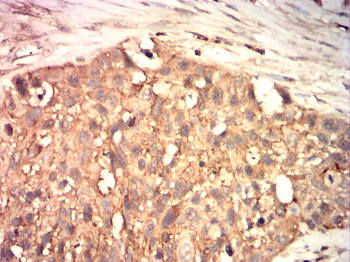 CTNNB1 Antibody