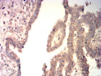 JUP Antibody