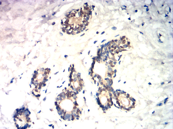 E2F1 Antibody