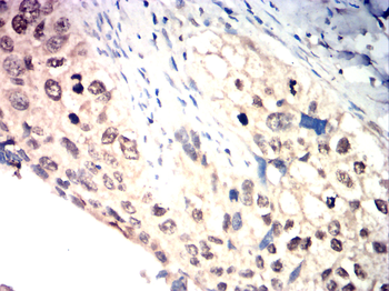 E2F1 Antibody