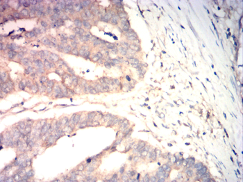 VEGFB Antibody