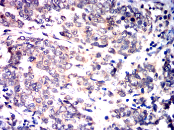 TERT Antibody