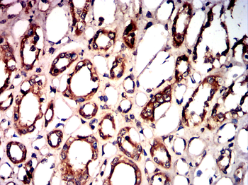 TERT Antibody