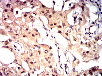 TERT Antibody
