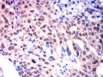 TERT Antibody