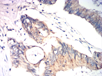 RIPK3 Antibody