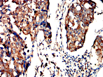 ITGAX Antibody