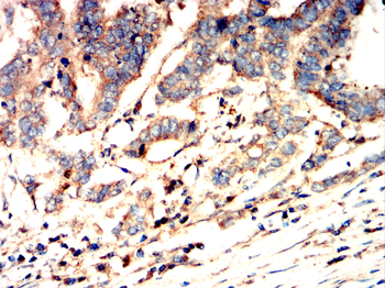ITGAX Antibody