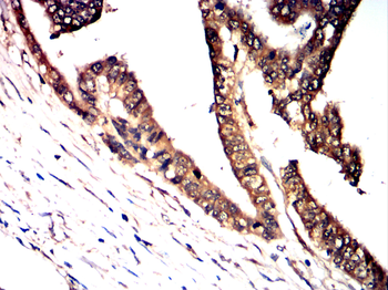 BAK1 Antibody