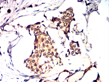 HDAC1 Antibody
