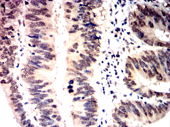 HDAC1 Antibody