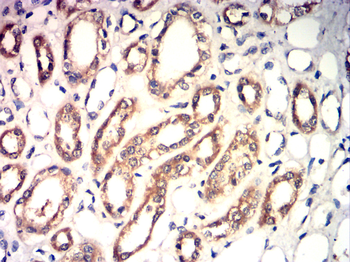 GAD1 Antibody