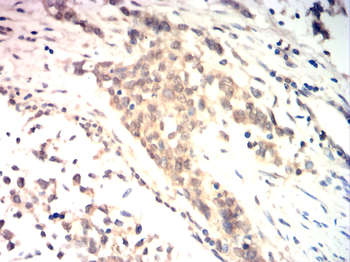 GAD1 Antibody