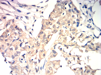 GAD1 Antibody