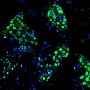 XRCC6 Antibody