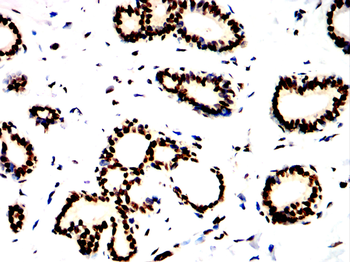 XRCC6 Antibody