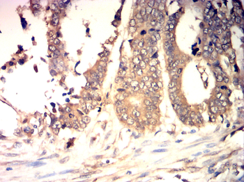 CDKN2B Rabbit Polyclonal Antibody