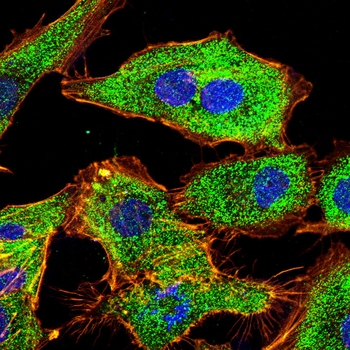 CDKN2B Rabbit Polyclonal Antibody