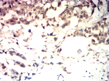 CDKN2B Rabbit Polyclonal Antibody