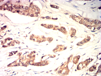 CDKN2B Rabbit Polyclonal Antibody