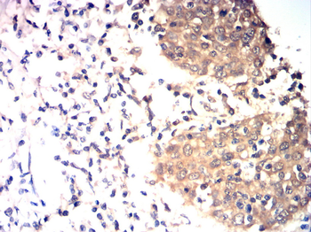 CDKN2B Rabbit Polyclonal Antibody