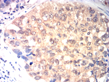 CDKN2B Rabbit Polyclonal Antibody