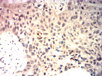 CDKN2B Rabbit Polyclonal Antibody