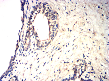 CDKN2B Rabbit Polyclonal Antibody