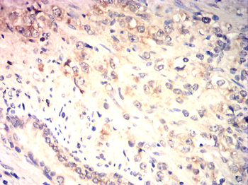 CDKN2B Rabbit Polyclonal Antibody