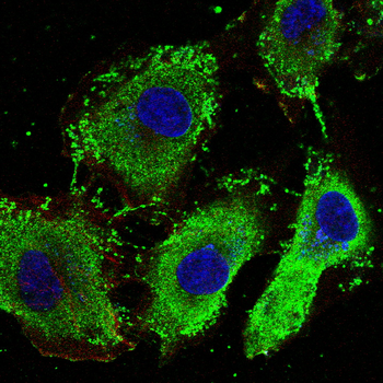 S100A1 Antibody