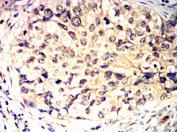GATA1 Antibody