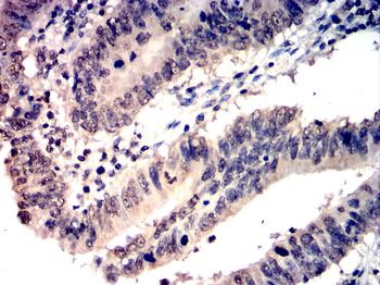 GATA1 Antibody