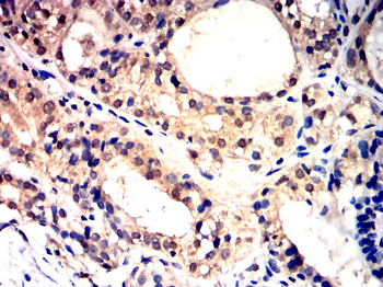 GATA1 Antibody