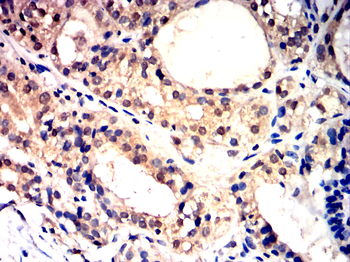 GATA1 Antibody