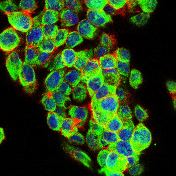 NOS2 Antibody