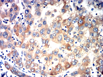 NOS2 Antibody