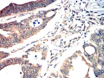 NOS2 Antibody