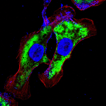 ALPP Antibody