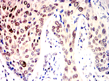 PCNA Rabbit Polyclonal Antibody