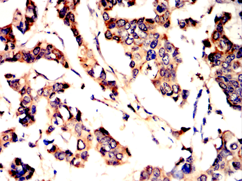 TSPO Antibody