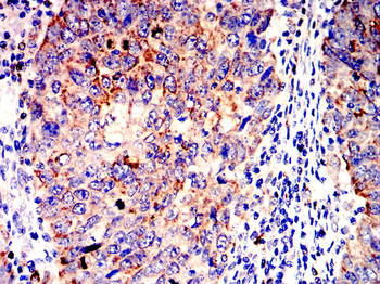 TSPO Antibody
