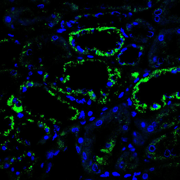 TSPO Antibody